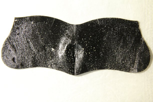 大量角蛋白塞和皮脂块与毛孔袋图片下载