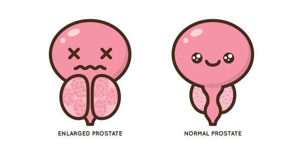 男性前列腺疾病载体图标平面插图图片下载