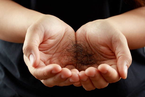 一个女人有很多脱发，她的头发和头皮有问题。图片下载