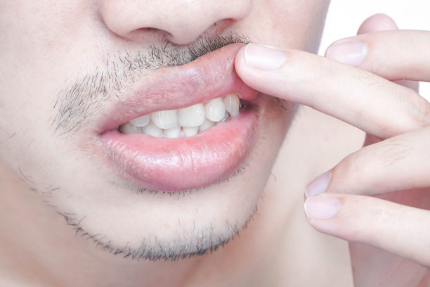 男人上唇特写与下唇缩小手术，以美容为理念图片下载