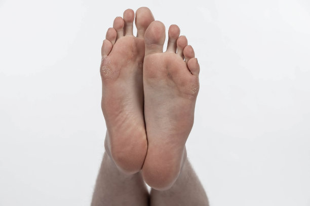 下面的白人青年赤裸疲惫的脚，干燥，剥落的皮肤，孤立在白色图片下载