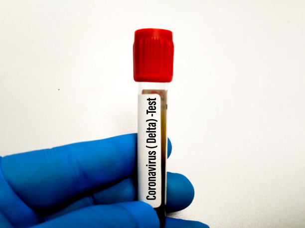 医生持有的血液样本管用于Covid -19，冠状病毒Delta +变异检测。在美国、印度和世界其他国家都有。关注的一种变体。图片下载