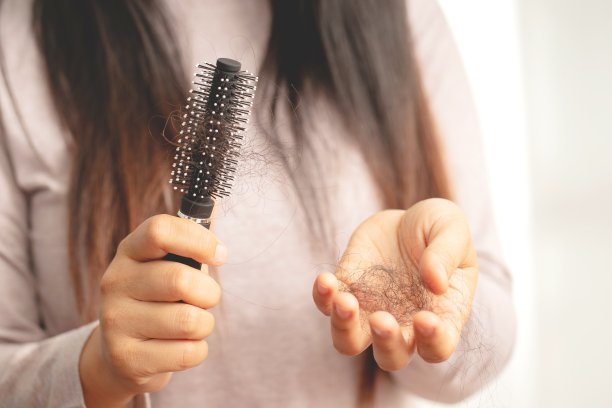 女性对洗发水过敏会导致脱发和头皮屑。图片下载