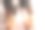 女性对洗发水过敏会导致脱发和头皮屑。图片下载