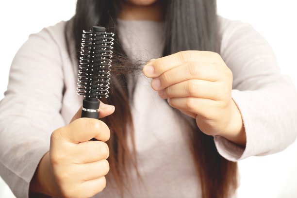 女性对洗发水过敏会导致脱发和头皮屑。图片下载