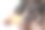 女性对洗发水过敏会导致脱发和头皮屑。图片下载