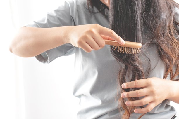 女性对洗发水过敏会导致脱发和头皮屑。图片下载