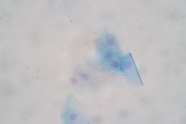 鳞状上皮细胞显微镜下的解剖和组织学特征，人和分离细胞。图片下载