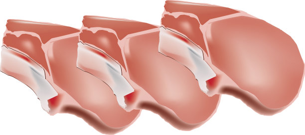 红肉排系列图片下载