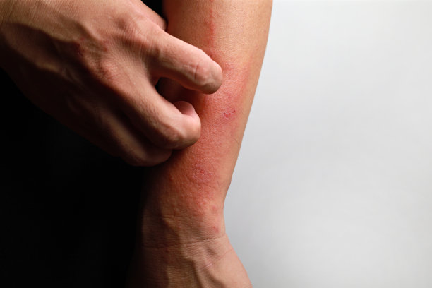 皮炎湿疹质地不良的人体皮肤闭合。图片下载