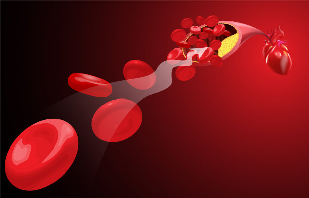 血流中的红血球被动脉粥样硬化阻塞图片下载