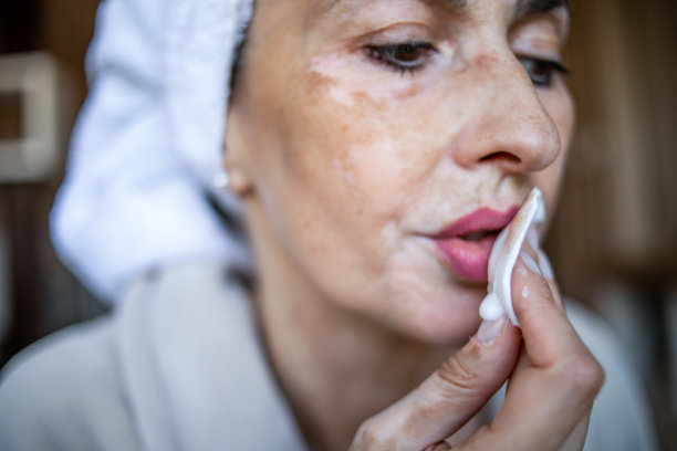 在家里照顾自己美丽的女人。白癜风。图片下载