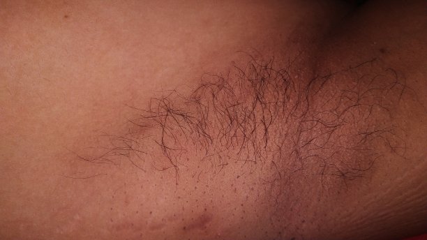 我的腋毛图片下载