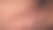 我的腋毛图片下载