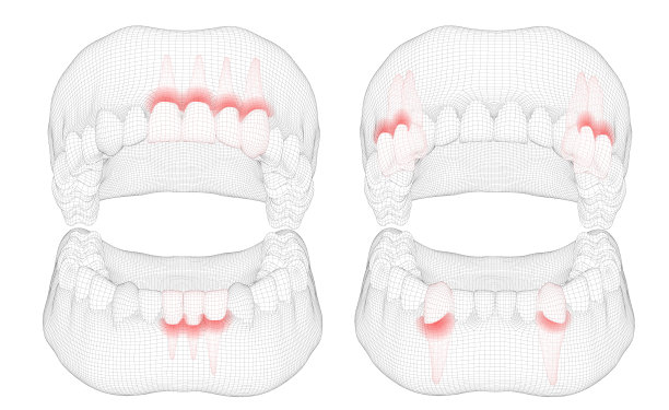 人体下颚3d布局医疗和健康疼痛的牙齿图片下载