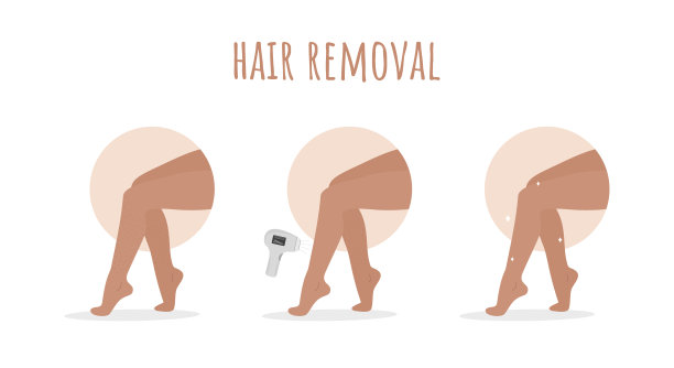 脱毛。激光拔毛。完美光滑的女性腿。之前和之后。一步一步的脱毛程序。矢量插图在平面卡通风格。皮肤护理的概念图片下载