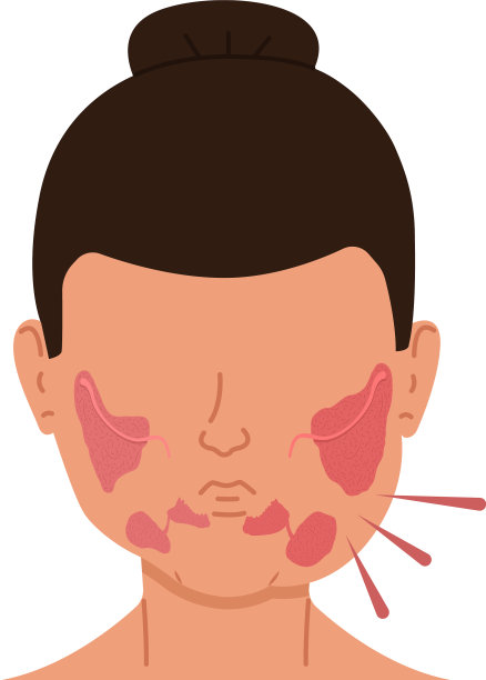 患有唾液腺发炎的女人图片下载