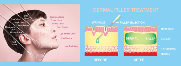 抗皱注射治疗区域。年轻女性，皮肤干净清新。美丽的女人。女性的脸和脖子。年轻白人女性的肖像。图片下载