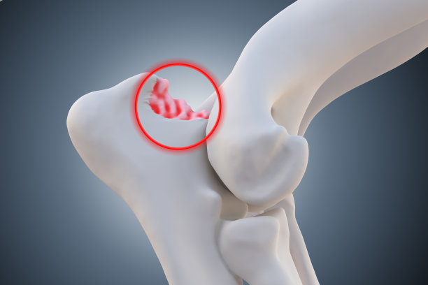 犬关节炎和骨关节炎关节炎症图片下载