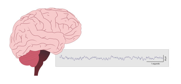 脑电波，脑电图(脑电图)插图图片下载