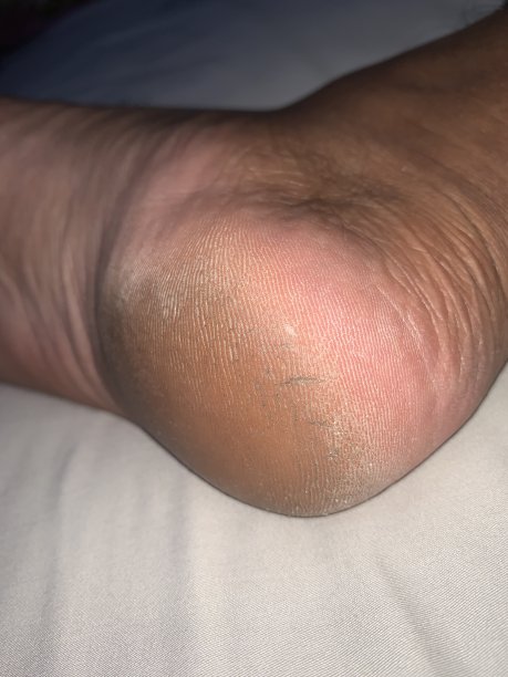 亚洲人跟图片下载