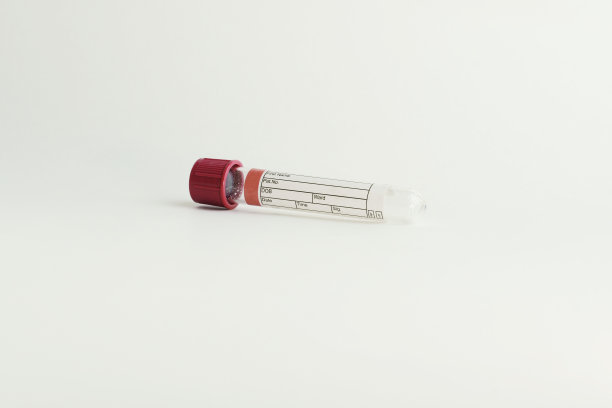 白色背景的真空管和血液样本。透明的红色盖子。标识数据的标签。有选择性的重点。盖子\图片下载