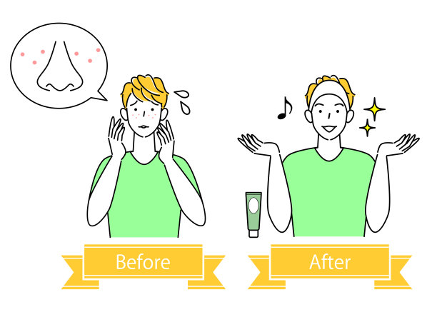 可爱的男人面部皮肤问题护理前后插图矢量素材图片下载