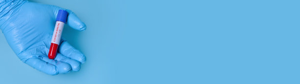 医生拿着一个新冠病毒变种或毒株呈阳性的血液样管。横幅。文本复制空间图片下载