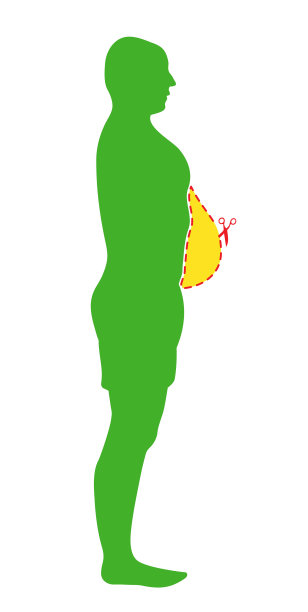 减肥的概念。饮食和健身前后。不同重量的身体。健康的生活方式。图片下载