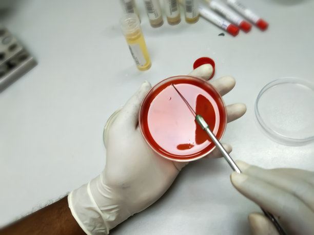 用血琼脂培养基和Hicrome、UTI琼脂进行微生物接种。图片下载