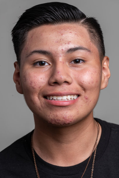 微笑的西班牙裔少年，灰色背景上长着痤疮图片下载