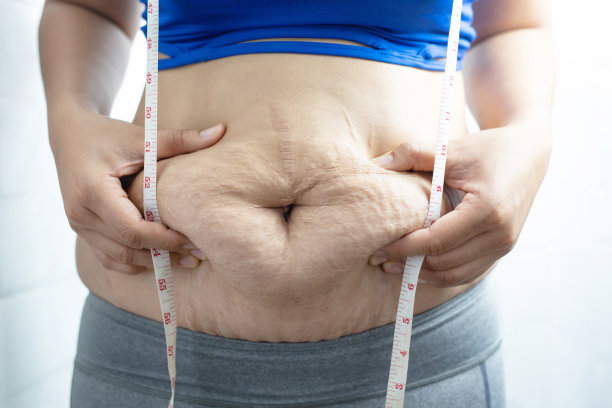 肥胖的女人需要控制体重，她有多余的脂肪。图片下载