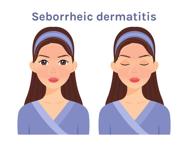 脂溢性皮炎。孤立的美丽的黑发女人。可爱的脸。皮肤疾病。女人睁着眼睛，闭着眼睛。白色背景。彩色平面卡通插图。矢量插图。图片下载
