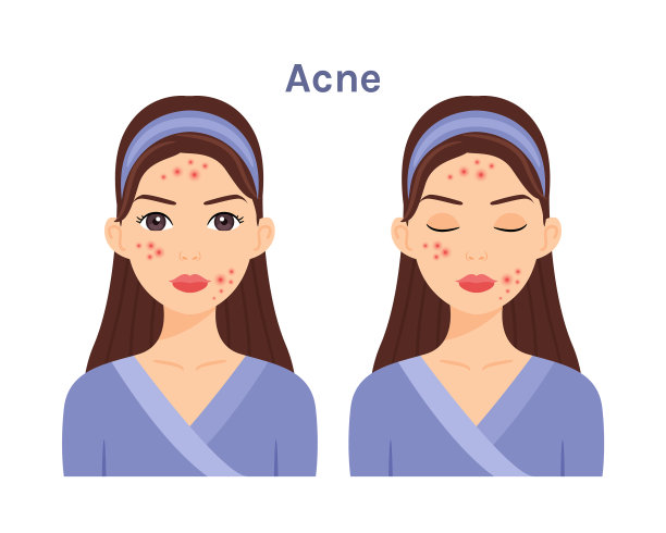 美丽的女人与痤疮问题皮肤图片下载