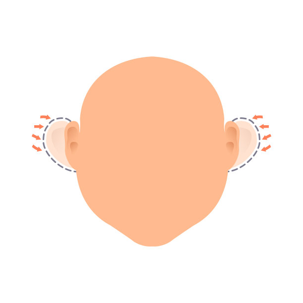 耳廓成形术前后治疗图片下载