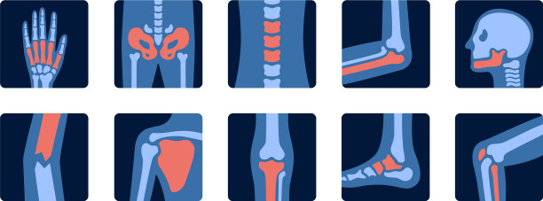 x光人体关节解剖与疼痛部位图片下载