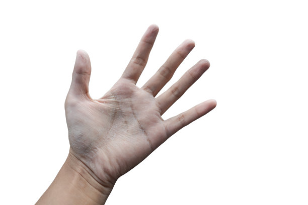 干燥龟裂的皮肤微距特写，年轻女性的手掌脱皮显示湿疹，医学状况称为湿疹性肾小球炎或水疱性肾小球炎孤立在白色背景上图片下载