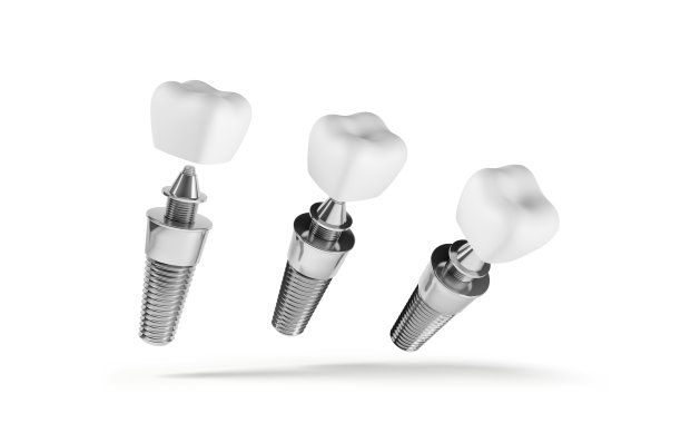 从白色背景中分离出种植体图片下载