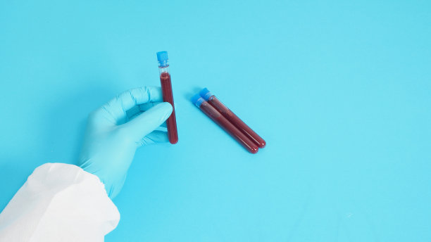 手穿着个人防护装备，手拿着血液试管，戴着蓝色背景的医用手套。图片下载