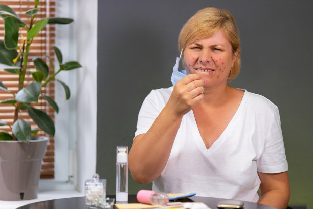 美丽的白人女性有痤疮问题的脸上，感觉刺激和疼痛后，脱下医用口罩。图片下载