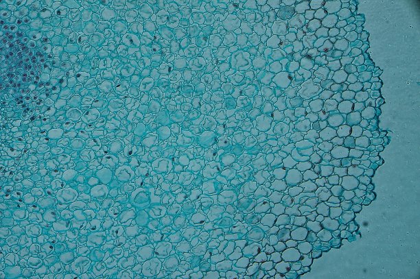 显微镜下骨骼肌ct图片下载