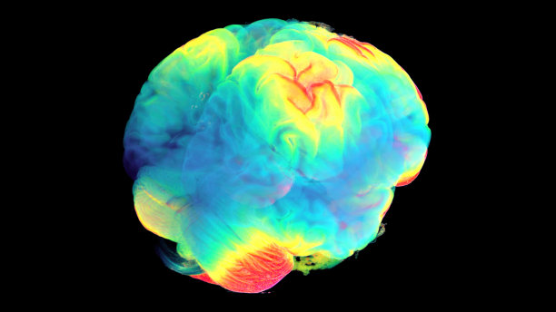 利用MTR和断层扫描技术，对人类大脑进行数字研究的三维可视化。作为这项研究的结果，获得了关于患者在临床阶段和六个月缓解后的大脑变化的完整信息。图片下载