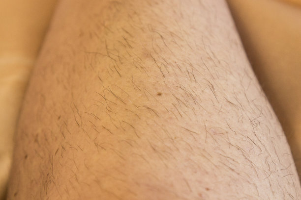 女性腿上的毛发。向内生长的头发问题。毛女腿图片下载