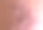 特写凹凸不平的皮肤与瑕疵和鳞片表皮，皮肤病学和皮肤疾病图片下载