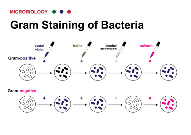 微生物学图显示革兰氏染色技术鉴定革兰氏阳性和阴性细菌图片下载
