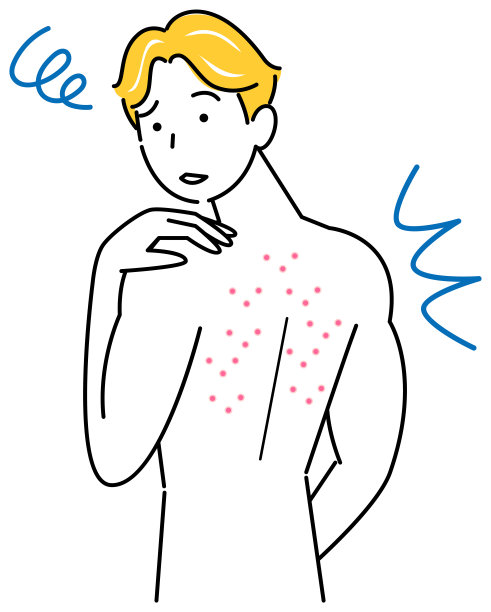 皮肤护理可爱的男人谁是悲伤的锅(吹和bikibi)在背上简单的向量 皮肤护理。一个可爱的家伙，因为背上长了青春痘而难过。简单的说明。向量。图片下载