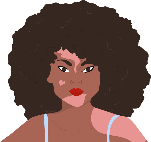 有皮肤问题的女孩接受自己图片下载