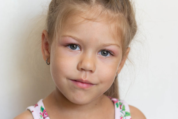 白人小女孩的肖像，五岁，眼睛肿胀，因为过敏，结膜炎和腺样体在白色背景图片下载