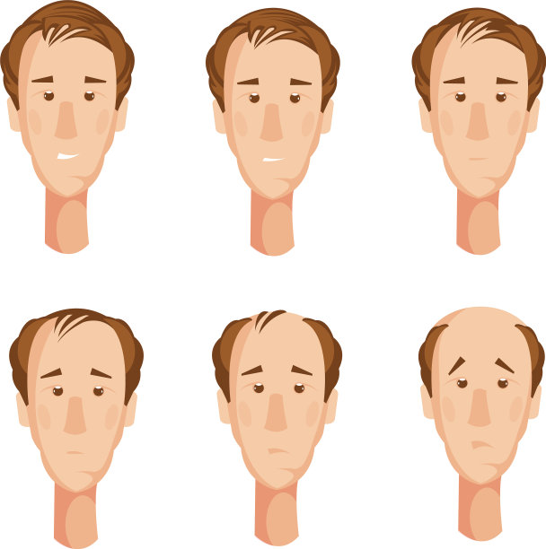 秃顶男人的头固定图片下载