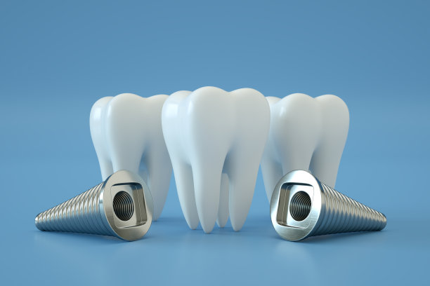 种植牙，人工牙，种植牙，蓝色背景图片下载